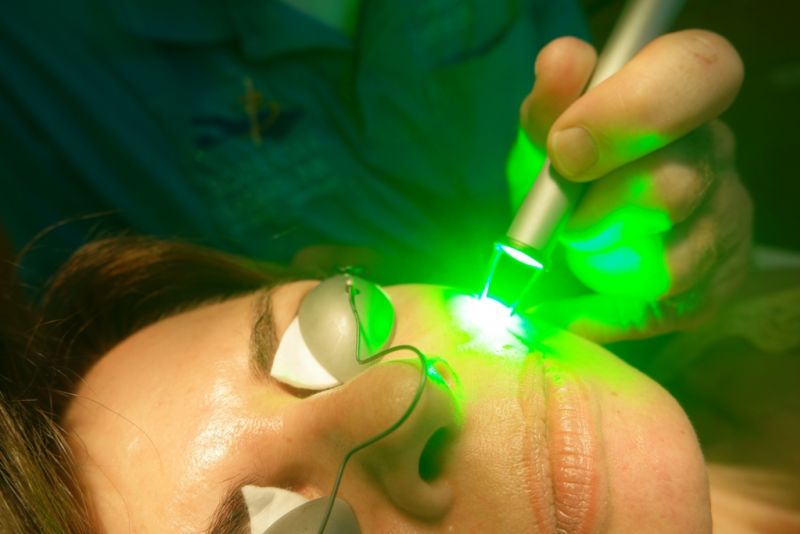 KTP Laser Bodensee Laserklinik Dr. Martin Braun Hautarzt Überlingen